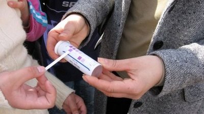 Jugendliche beim PH-Wert-messen